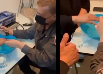 נישואין זה כואב: כבאי חילץ טבעת נישואין מאצבעה של תושבת חריש